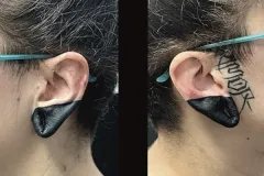 Un díptico que muestra un primer plano de una oreja con un tatuaje blackout sólido de color negro que cubre todo el lóbulo. En la imagen de la izquierda se ve la oreja desde un ángulo trasero, mientras que en la imagen de la derecha se observa un perfil lateral que deja ver un tatuaje de caligrafía con líneas finas. Tatuaje blackwork por Agu en Hipno Tattoo Estepona.